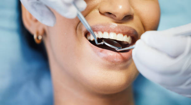 Best Emergency Denture Repair in Yorkville, NY